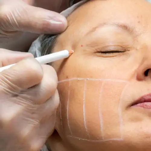 The Beautique Aesthetics Beauty Treatments West Runton Cromer