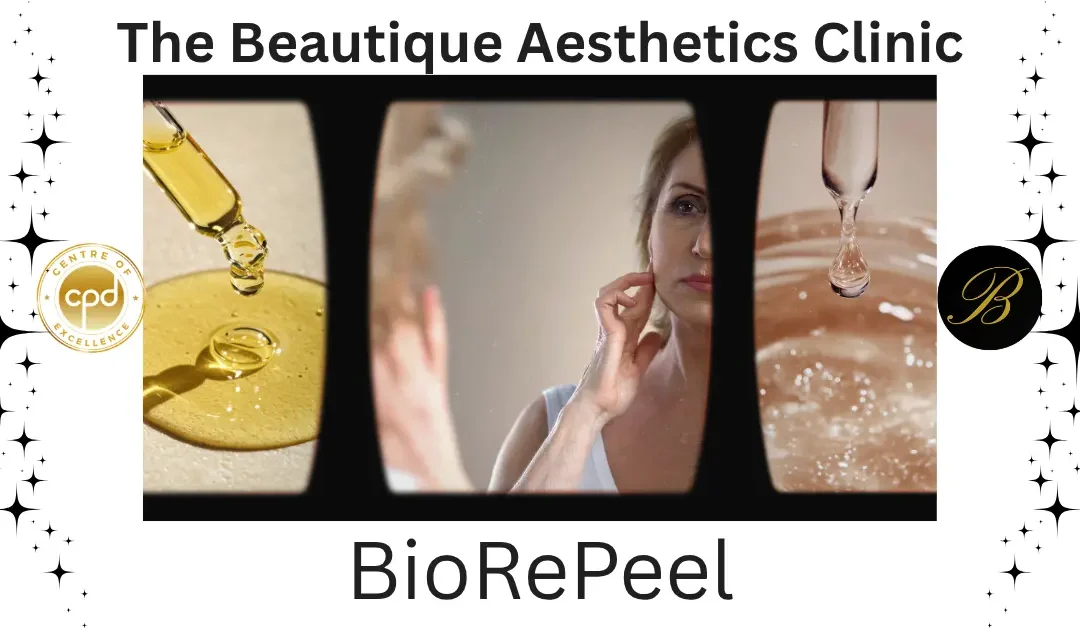 5 Reasons to Choose BioRePeel Facial for Skin Rejuvenation
