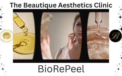 5 Reasons to Choose BioRePeel Facial for Skin Rejuvenation